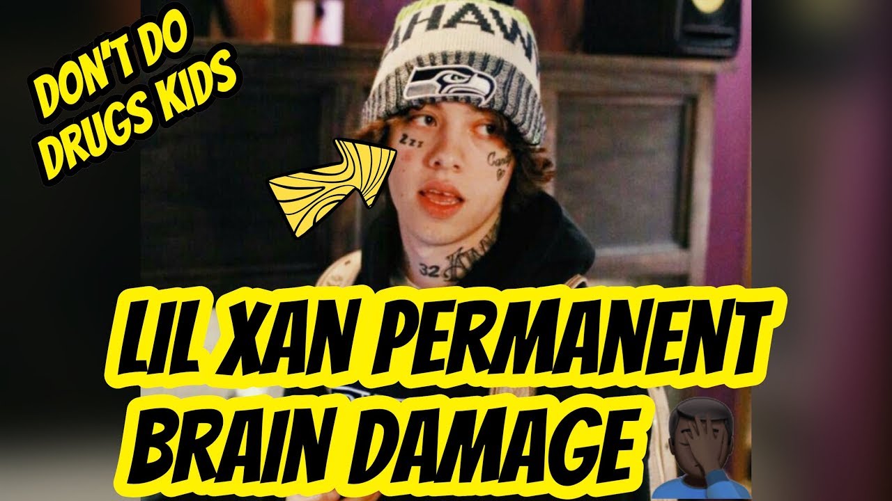 Lil Xan Permanent Brain Damage Dont Do Drugs Kids Youtube