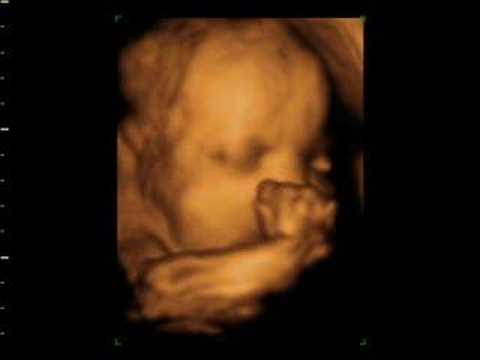 gary cahill Window to the womb 4d baby scan of angie and gary
