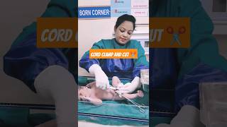 cord clamp and cut after delivery of babynewbornshortsvideo