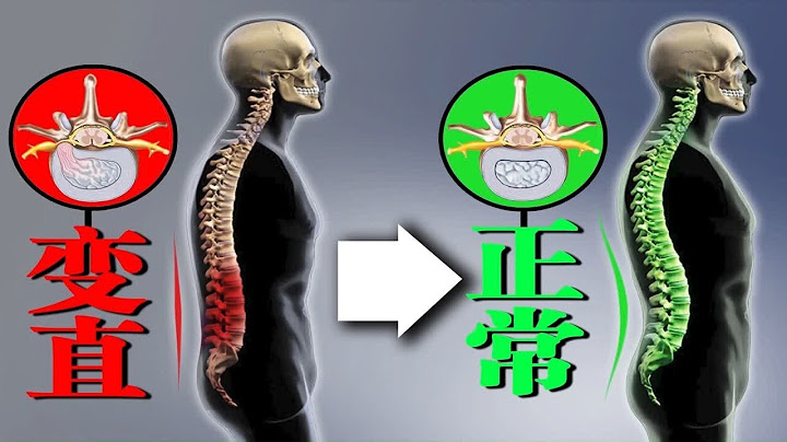 久坐腰痛？可能腰椎曲度变直，针对训练有效改善腰椎曲度丨 Effectively improve lumbar curvature for training