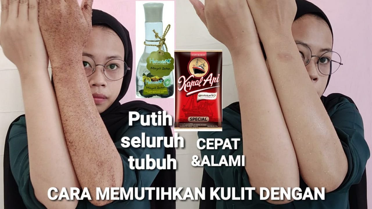 CARA MEMUTIHKAN KULIT TANGAN, KAKI DAN SELURUH BADAN DENGAN CEPAT ALAMI