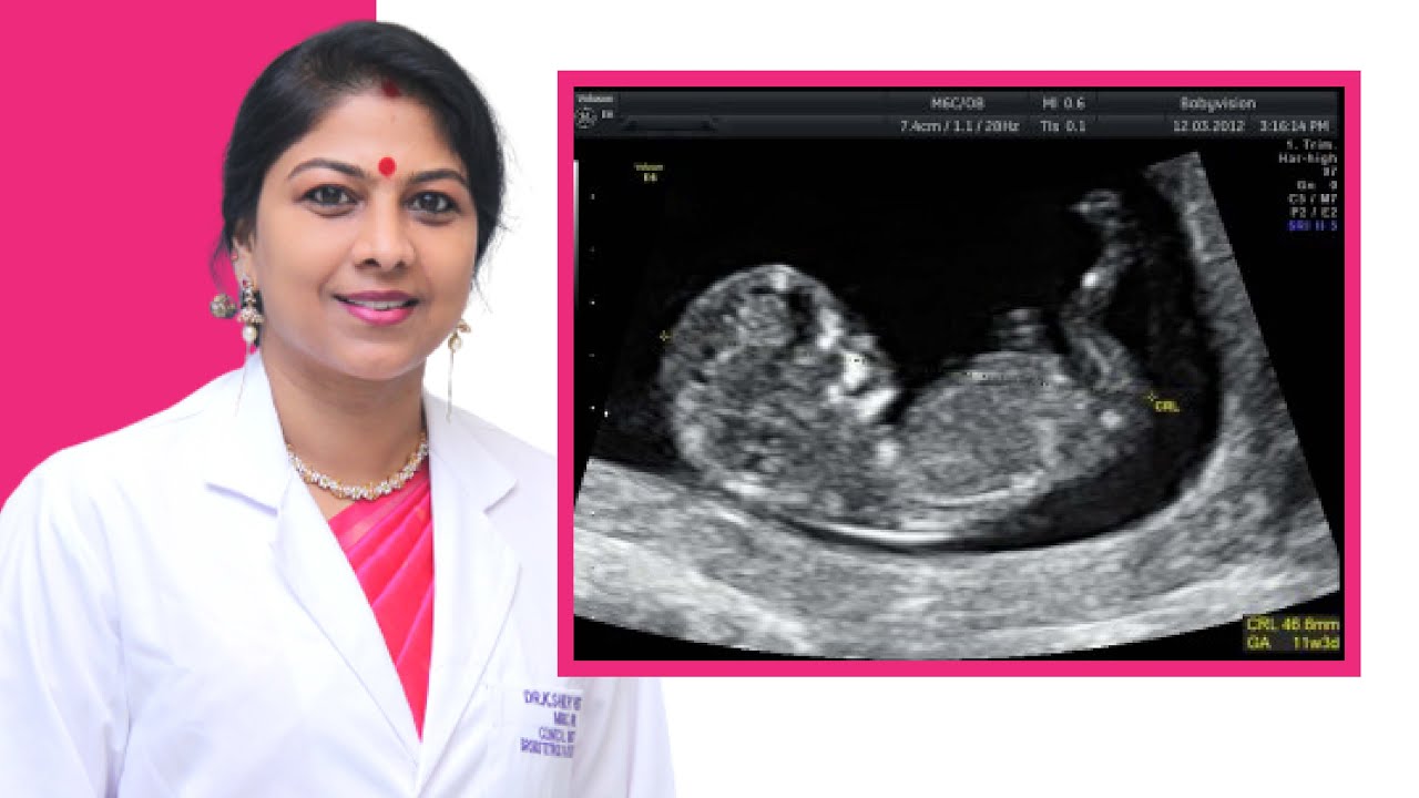 ప్రెగ్నన్సీ సమయం లో ఎన్నిScans అవసరము | scanning pregnancy telugu - in detail | Dr k Shilpi Reddy