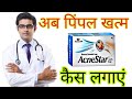 Acne star Soap Honest review 2023 in hindi | how to use acne star Soap