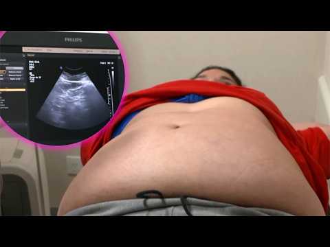 "NUNCA ME LO HICE": la primera ecografía abdominal de Micaela en su vida, para detectar hígado graso