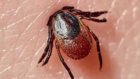 Co nám může infikované klíště způsobit?