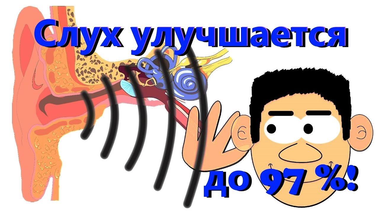 КАК восстановить СЛУХ. Простые рецепты. - YouTube