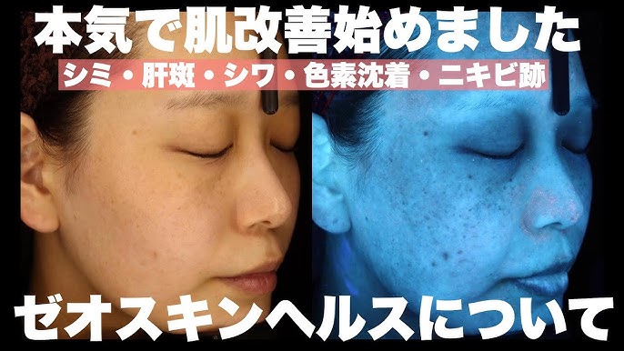 ノーファンデ肌 更に肌が綺麗になったゼオスキン維持期のスキンケアルーティン 美肌 By 桃桃 Youtube ノーファンデ肌 更に肌が綺麗になったゼオスキン維持期のスキンケアルーティン 美肌 By 桃桃 Youtube