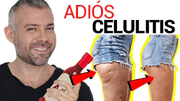 ¿Qué puedo tomar para reducir la celulitis?