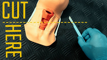 FONA: How To Perform CRICOTHYROIDOTOMY