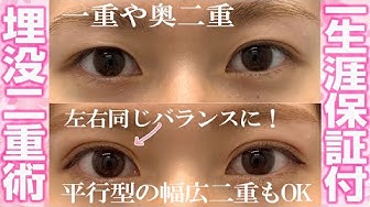二重整形 Youtube