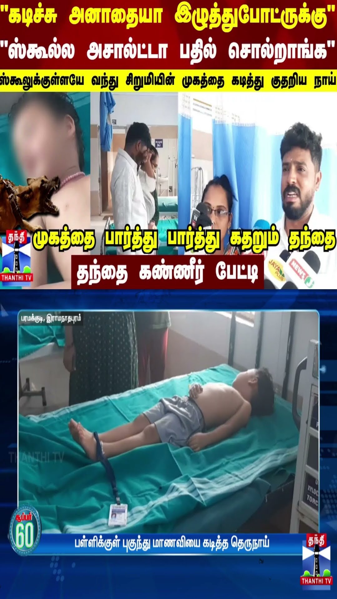ஸ்கூலுக்குள்ளயே வந்து சிறுமியின் முகத்தை கடித்து குதறிய தெருநாய்..தந்தை கண்ணீர் பேட்டி | Dog Bite