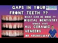 Gaps between your front teeth  smile designing  veneers  dr arunkumar  pearls dentistry