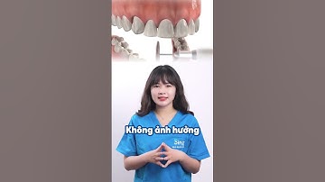 Mài răng khi niềng có ảnh hưởng gì không? #nhakhoasing #trending #xh #niengrang #dentist #braces