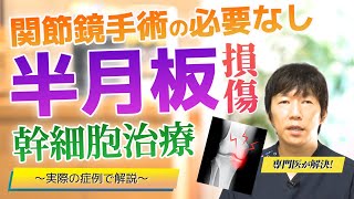 【半月板損傷の再生医療】関節鏡手術をしなくても完治！痛みがきれいに取れ、動きも正常に！実際の症状をレントゲン、MRIを使って医師が徹底解説！