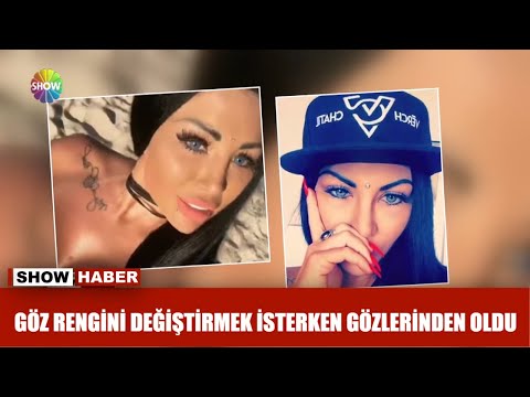 Göz rengini değiştirmek isterken gözlerinden oldu