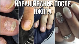 Наращивание после химическиго ожага// А может не стоило