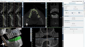 BSP4.11: Completely Automatic CT Tooth Segmentation