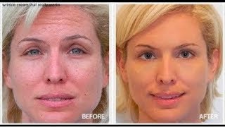 ⁣Eye Wrinkle Cream Reviews (How To Reduce Eye Wrinkles And Fine Lines)