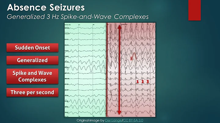 Absence Seizures: EEG Findings