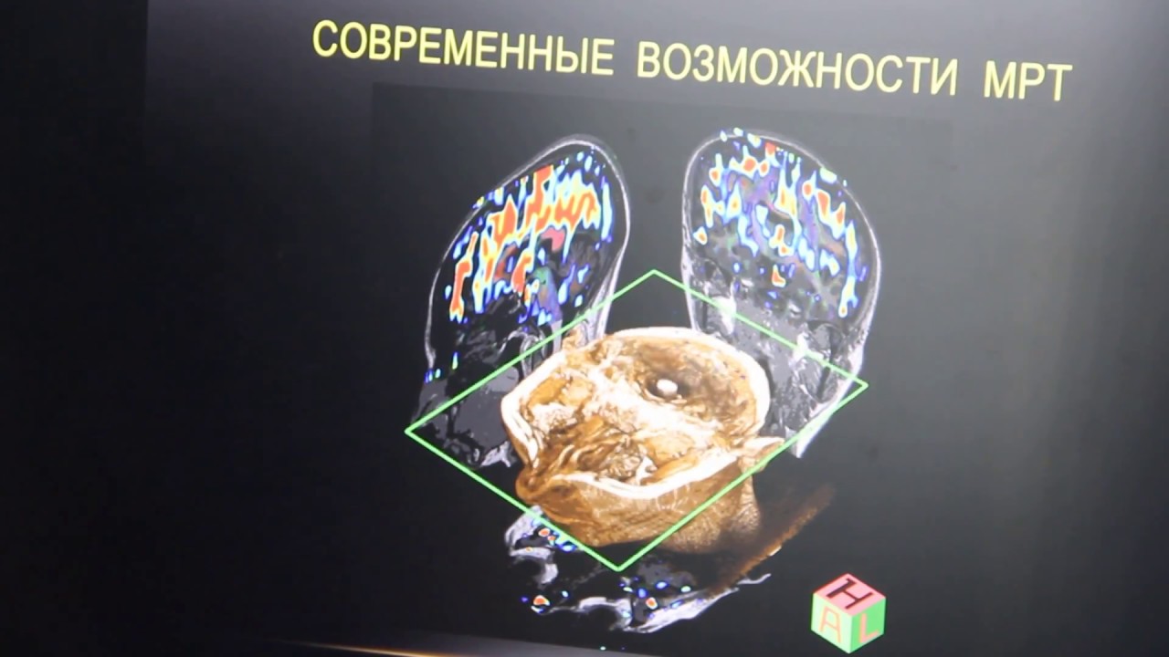 Сравнительная характеристика МРТ и КТ