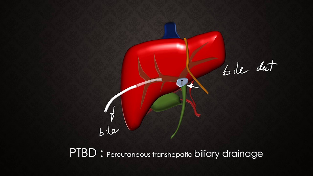 Drain for medical student (Thai)