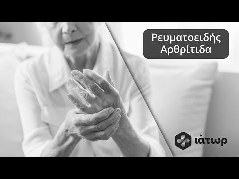 Ρευματοειδής Αρθρίτιδα - Rheumatoid Arthritis