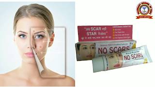 No Scars Cream || जले, कटे, सर्जरी, एक्सीडेंटल निशान को 6 weeks में हटायें।