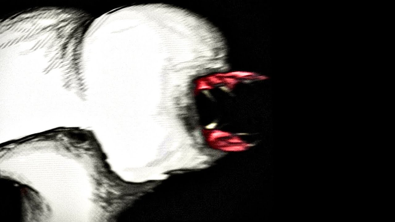 Alien - stages of infection (Analog horror) - YouTube