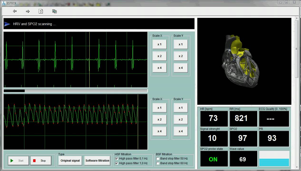 Monitoring Cases using EIS