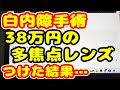 白内障手術 38万円の多焦点レンズを入れた6日目の正直な感想とは?