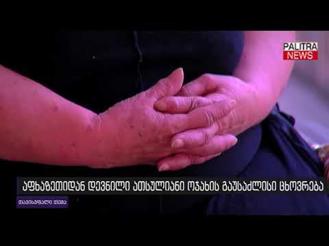 აფხაზეთიდან დევნილი ათსულიანი ოჯახის გაუსაძლისი ცხოვრება - თავისუფალი თემა