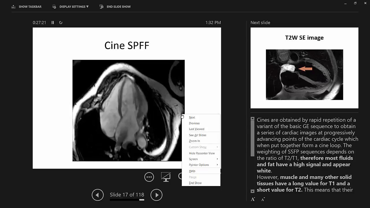CMT Tracings (Dr. rehab hamdy)