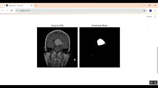 Brain MRI image Segmentation in Python Projects