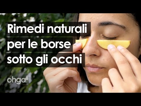 Video: I Migliori Rimedi Per Gli Occhi Rosa: Trattamenti Medici E Naturali