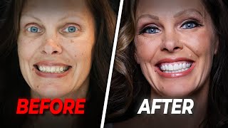 Pageant Winner's Secret Smile Makeover Reveal - No Cosmetic Dentist Needed! By BrighterImageLab.com