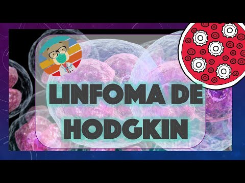Linfoma de Hodgkin - Fisiopatología y Tratamiento