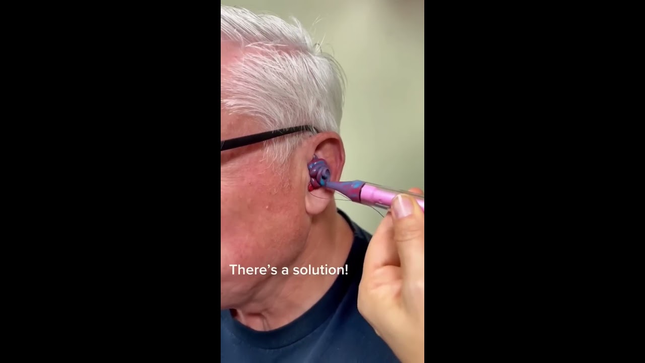 The Completely In Canal Hearing Aid Is Close To Invisible Oddlysatisfying Rochesterny Audiology