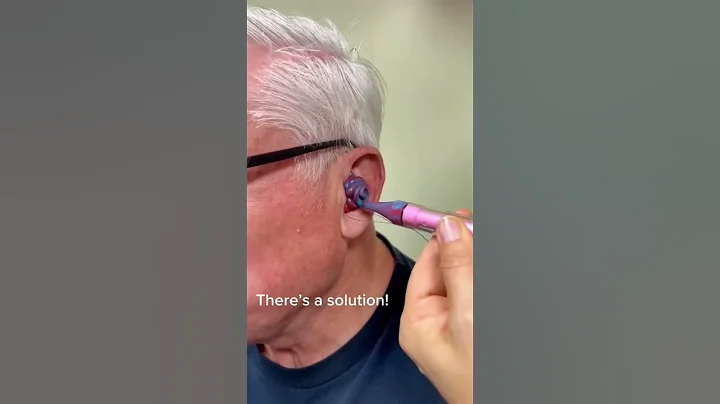The Completely In Canal Hearing Aid Is Close To Invisible! #oddlysatisfying #rochesterny #audiology - DayDayNews