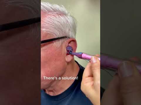 The Completely In Canal Hearing Aid Is Close To Invisible! #oddlysatisfying #rochesterny #audiology