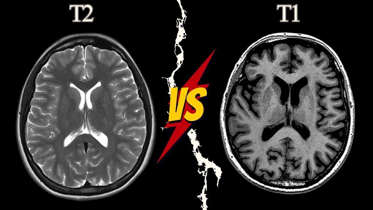 Difference between T1&T2 ||  T1& T2 الفرق بين