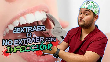 ¿Es necesario tomar antibióticos antes de una extracción dental?