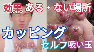 カッピング(吸い玉)の効果を感じた・感じない場所