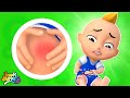 Owie owie ouch boo boo song  nursery rhymes by boombuddies