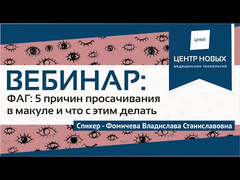 Вебинар ФАГ: 5 причин просачивания в макуле и что с этим делать?   Фомичева В.С.