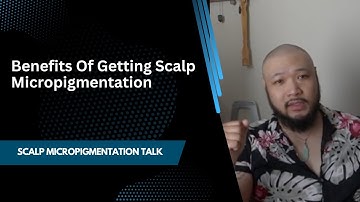 Benefits of Getting Scalp Micropigmentation