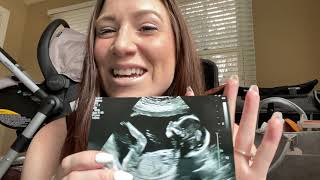 Weeks 20 & 21 Pregnancy Update with #RainbowBaby | Ultrasound + Pregnant after Miscarriage Feelings