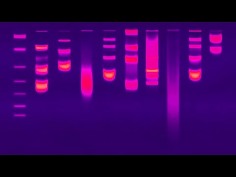 Video: Welke factor gebruikt gelelektroforese om de quizlet van DNA-moleculen te scheiden?