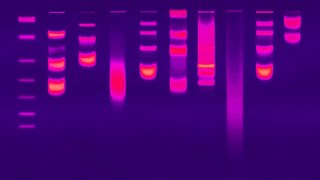 Gel Electrophoresis