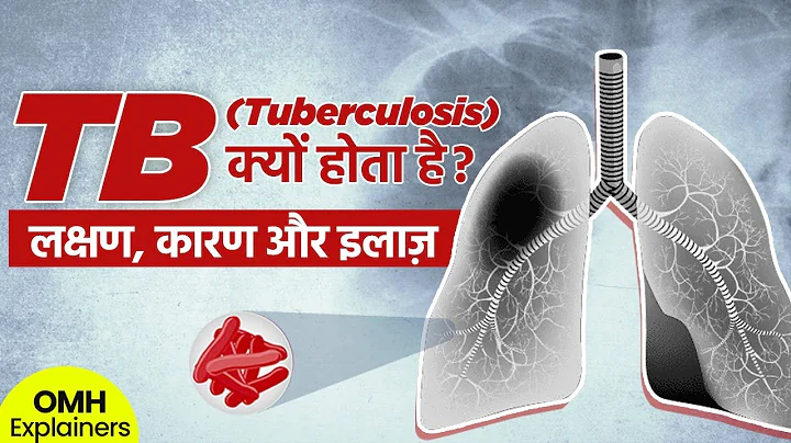 Tuberculosis TB क्यों होता है I लक्षण, कारण और इलाज़ I World TB Day I OMH Explainers