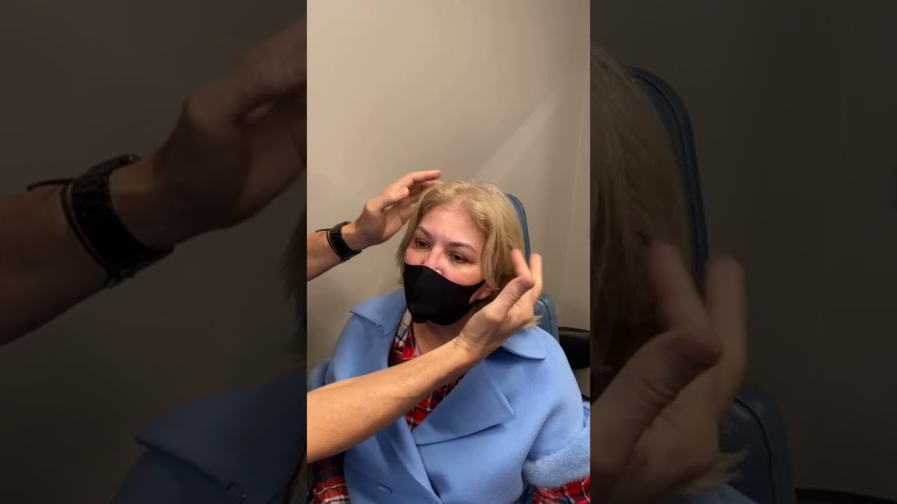 Brow Lift Patient Regains Youthful Appearance 2 Months After Surgery With Dr. Philip Miller